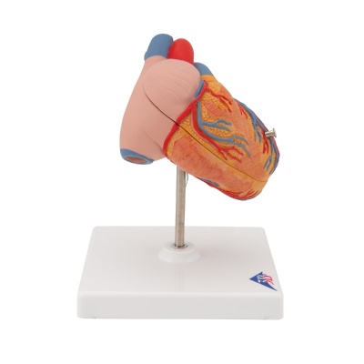 3B Scientific 2-Part Anatomical Heart Model with Left Ventricular Hypertrophy